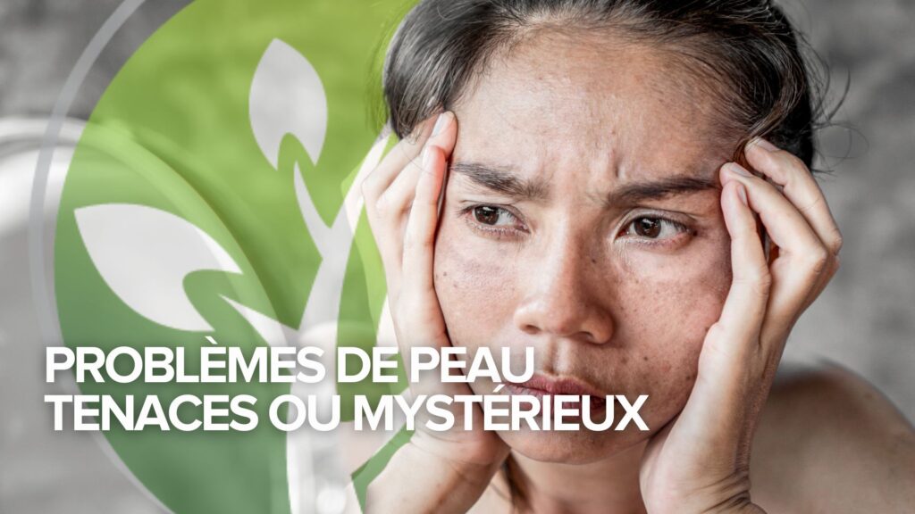 Témoignage du mardi : Problèmes de peau tenaces ou mystérieux Témoignage du mardi : Problèmes de peau tenaces ou mystérieux